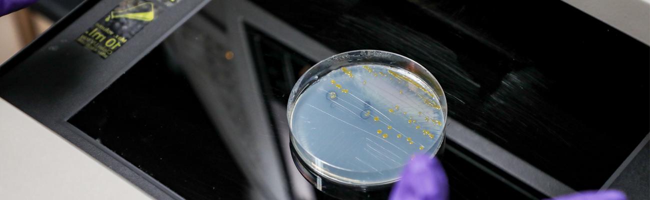 培养皿中生长的细菌